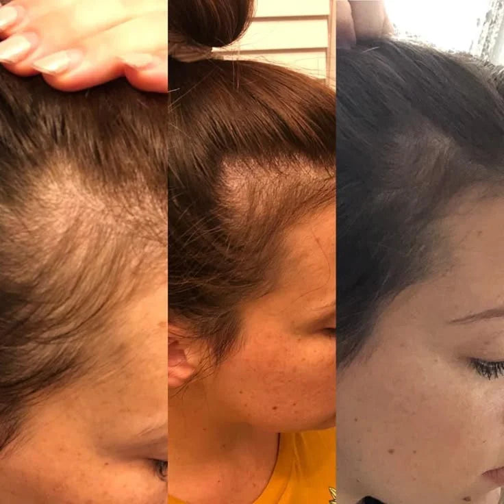 Aceite de Batana 100% Puro – Nutre, Fortalece y Estimula el Crecimiento del Cabello