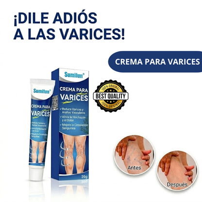 Crema Para Varices - Tratamiento Potente Para Aliviar Varices y Piernas