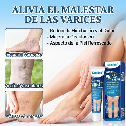 Crema Para Varices - Tratamiento Potente Para Aliviar Varices y Piernas