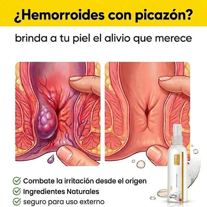 Gel Antihemorroides™ - Tratamiento de Máxima Potencia para aliviar las Hemorroides